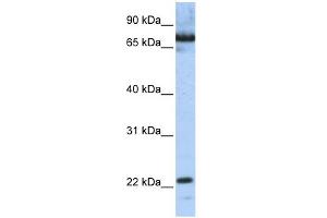 WB Suggested Anti-SCAND1 Antibody Titration:  0. (SCAND1 Antikörper  (N-Term))