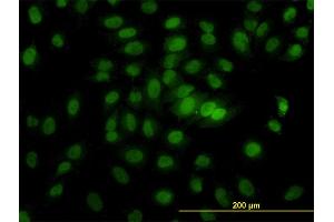 Immunofluorescence of monoclonal antibody to CSE1L on HeLa cell. (Exportin 2 Antikörper  (AA 872-971))