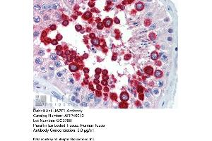 Immunohistochemistry with Human Testis lysate tissue at an antibody concentration of 5. (JAZF1 Antikörper  (C-Term))
