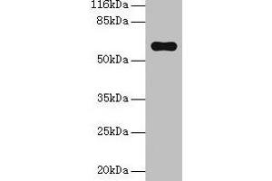Western blot All lanes: Pklr antibody at 2 μg/mL + Hela whole cell lysate Secondary Goat polyclonal to rabbit IgG at 1/10000 dilution Predicted band size: 63, 59 kDa Observed band size: 63 kDa (PKLR Antikörper  (AA 1-574))