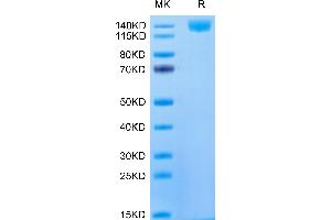 CD21 Protein (AA 12-963) (His tag)