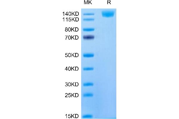 CD21 Protein (AA 12-963) (His tag)