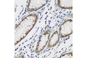 Immunohistochemistry of paraffin-embedded human stomach using TTBK2 antibody (ABIN6131392, ABIN6149666, ABIN6149669 and ABIN6223523) at dilution of 1:200 (40x lens). (TTBK2 Antikörper  (AA 1185-1244))