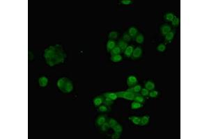Immunofluorescent analysis of PC-3 cells using ABIN7168135 at dilution of 1:100 and Alexa Fluor 488-congugated AffiniPure Goat Anti-Rabbit IgG(H+L) (RAVER2 Antikörper  (AA 2-691))
