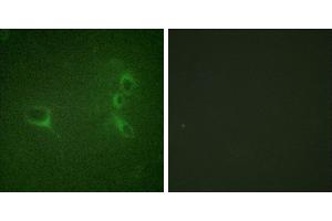 P-peptide - +Immunofluorescence analysis of NIH/3T3 cells, using Bcr (Phospho-Tyr360) antibody. (BCR Antikörper  (pTyr360))
