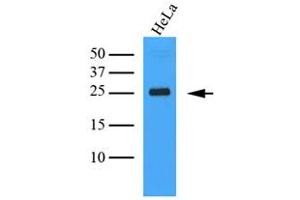 The Cell lysates (40ug) were resolved by SDS-PAGE, transferred to PVDF membrane and probed with anti-human MINCLE antibody (1:1000). (CLEC4E Antikörper)