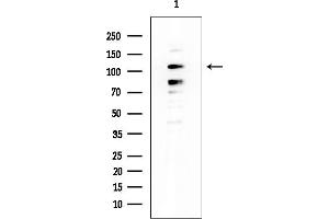 anti-MCF.2 Cell Line Derived Transforming Sequence (MCF2) (Internal Region) antibody