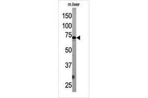 The ATG7 Antibody (Center) Pab (ABIN388521 and ABIN2849641) is used in Western blot to detect G7L in mouse liver tissue lysate.