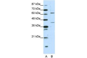 WB Suggested Anti-FOXP4 Antibody Titration:  1. (FOXP4 Antikörper  (C-Term))