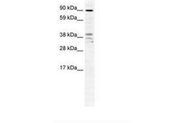 ZC3H7B Antikörper  (AA 136-185)
