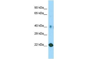 Host: Rabbit Target Name: C11orf34 Sample Type: HT1080 Whole Cell lysates Antibody Dilution: 1. (Plet1 Antikörper  (Middle Region))
