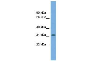 WB Suggested Anti-DAPP1  Antibody Titration: 0. (DAPP1 Antikörper  (Middle Region))