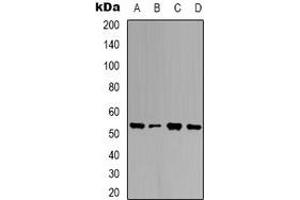 Western blot analysis of Ubiquilin 4 expression in HEK293T (A), K562 (B), NIH3T3 (C), mouse brain (D) whole cell lysates.
