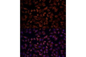 Immunofluorescence analysis of L929 cells using [KO Validated] KRAS Rabbit pAb (ABIN6132168, ABIN6143000, ABIN6143001 and ABIN6216439) at dilution of 100 (40x lens). (K-RAS Antikörper  (AA 30-188))