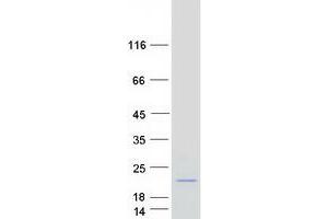 Histone H2B Type 1-M protein (Myc-DYKDDDDK Tag)