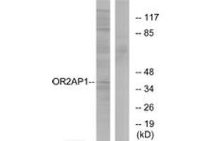Western blot analysis of extracts from Jurkat cells, using OR2AP1 Antibody. (OR2AP1 Antikörper  (AA 231-280))