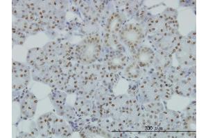 Immunoperoxidase of monoclonal antibody to SMC1L1 on formalin-fixed paraffin-embedded human salivary gland. (SMC1A Antikörper  (AA 366-465))
