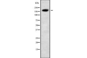 Western blot analysis of ALS2 using MCF7 whole cell lysates (ALS2 Antikörper  (N-Term))