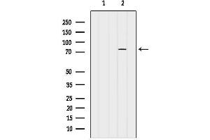 anti-Poly (ADP-Ribose) Polymerase 2 (PARP2) (Internal Region) antibody