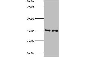 Western blot All lanes: Estrogen sulfotransferase antibody at 7 μg/mL Lane 1: Mouse lung tissue Lane 2: Mouse liver tissue Secondary Goat polyclonal to rabbit IgG at 1/10000 dilution Predicted band size: 35, 30 kDa Observed band size: 35 kDa (SULT1E1 Antikörper  (AA 140-294))