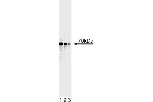 Western Blotting (WB) image for anti-Tumor Protein P73 (TP73) (AA 380-367) antibody (ABIN967629) (Tumor Protein p73 Antikörper  (AA 380-367))