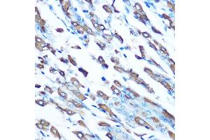 Immunohistochemistry of paraffin-embedded mouse stomach using DMT1 Rabbit pAb (ABIN6129471, ABIN6147839, ABIN6147840 and ABIN6214400) at dilution of 1:100 (40x lens). (SLC11A2 Antikörper  (AA 1-100))