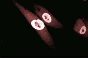 Immunofluorescence staining of human fibroblasts. (GSTP1 Antikörper  (AA 5-210))