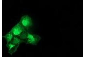 Anti-CAT mouse monoclonal antibody (ABIN2454330) immunofluorescent staining of COS7 cells transiently transfected by pCMV6-ENTRY CAT (RC210763). (Catalase Antikörper)
