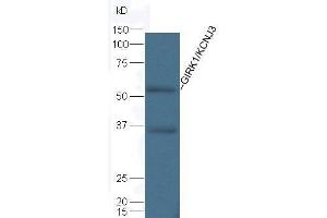 Mouse kidney lysate probed with Rabbit Anti-GIRK1 Polyclonal Antibody  at 1:5000 90min in 37˚C (KCNJ3 Antikörper  (AA 81-180))