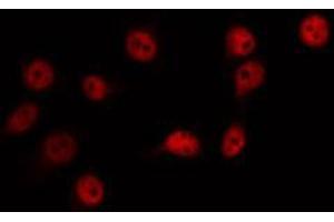 ABIN6266718 staining Hela by IF/ICC. (ZIC1/2/3 Antikörper)