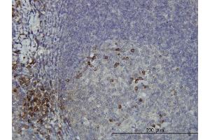 Immunoperoxidase of monoclonal antibody to DCAKD on formalin-fixed paraffin-embedded human tonsil. (DCAKD Antikörper  (AA 113-200))