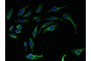 Immunofluorescent analysis of Hela cells using ABIN7142788 at dilution of 1:100 and Alexa Fluor 488-congugated AffiniPure Goat Anti-Rabbit IgG(H+L)