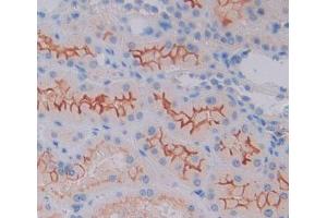 Used in DAB staining on fromalin fixed paraffin- embedded kidney tissue (CAMK1 Antikörper  (AA 1-370))