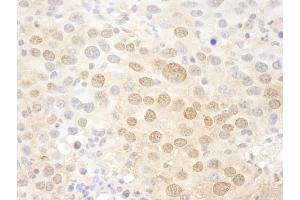 Immunohistochemistry (IHC) image for anti-Proprotein Convertase Subtilisin/kexin Type 2 (PCSK2) (AA 150-200) antibody (ABIN7448718)