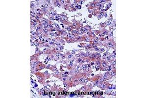 Immunohistochemistry (IHC) image for anti-Complement Decay-Accelerating Factor (CD55) antibody (ABIN2998248) (CD55 Antikörper)