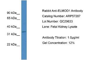 WB Suggested Anti-ELMOD1  Antibody Titration: 0. (ELMOD1 Antikörper  (Middle Region))