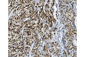 IHC analysis of PON1 using anti-PON1 antibody (ABIN7600530). (PON1 Antikörper  (AA 20-252))