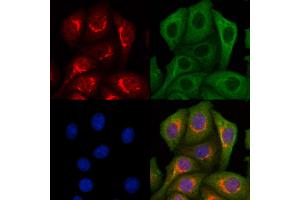 ABIN7094340 and ABIN7098387 staining Hela cells by IF/ICC. (LETM2 Antikörper  (C-Term))