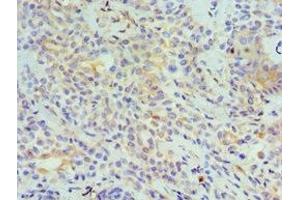 Immunohistochemistry (IHC) image for anti-Tumor Necrosis Factor (Ligand) Superfamily, Member 13 (TNFSF13) (AA 105-247) antibody (ABIN7173799)
