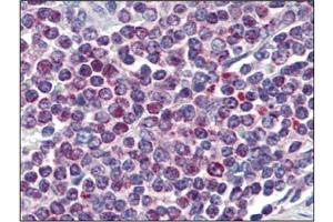 Immunohistochemistry (IHC) image for anti-Nuclear Factor of Activated T-Cells, Cytoplasmic, Calcineurin-Dependent 1 (NFATC1) (AA 428-716) antibody (ABIN336112)