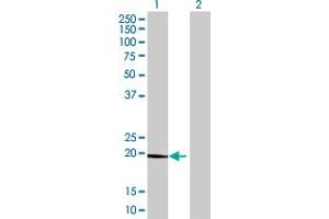Western Blot analysis of CLEC3B expression in transfected 293T cell line by CLEC3B MaxPab polyclonal antibody. (CLEC3B Antikörper  (AA 1-202))
