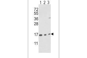 Western blot analysis of IA Antibody (N-term) (ABIN389487 and ABIN2839546) in T47D cell line(lane 1) and mouse brain(lane 2),bladder(lane 3) tissue lysates (35 μg/lane). (PPIA Antikörper  (N-Term))