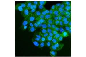 IF analysis of IGF2R using anti-IGF2R antibody (ABIN7601705). (IGF2R Antikörper  (AA 424-529))