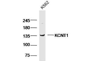 K562 cell lysates probed with KCNT1 Polyclonal Antibody, unconjugated  at 1:300 overnight at 4°C followed by a conjugated secondary antibody for 60 minutes at 37°C. (KCNT1 Antikörper  (AA 101-200))