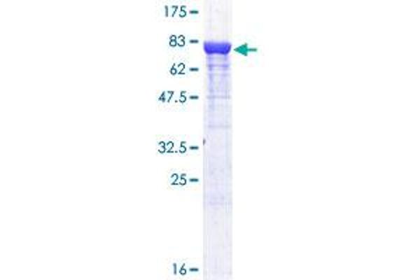 PKM2 Protein (AA 1-531) (GST tag)