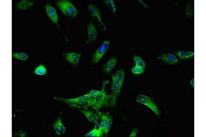 Immunofluorescent analysis of Hela cells using ABIN7164372 at dilution of 1:100 and Alexa Fluor 488-congugated AffiniPure Goat Anti-Rabbit IgG(H+L) (DDX6 Antikörper  (AA 1-149))