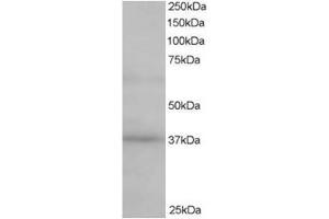 Image no. 1 for anti-ATPase, H+ Transporting, Lysosomal Accessory Protein 2 (ATP6AP2) (C-Term) antibody (ABIN374363)