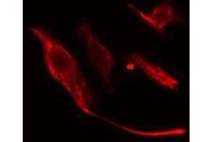 ABIN6275673 staining NIH-3T3 cells by IF/ICC. (VTI1A Antikörper  (Internal Region))