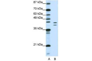HNRPD antibody used at 1. (HNRNPD/AUF1 Antikörper)