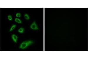 Immunofluorescence analysis of HuvEc cells, using Cytochrome P450 2W1 Antibody.